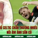 Cầu Thủ Celtic Chấn Thương Nhiều Nhất – Nỗi Ám Ảnh Sân Cỏ
