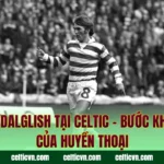 Kenny Dalglish Tại Celtic – Bước Khởi Đầu Của Huyền Thoại