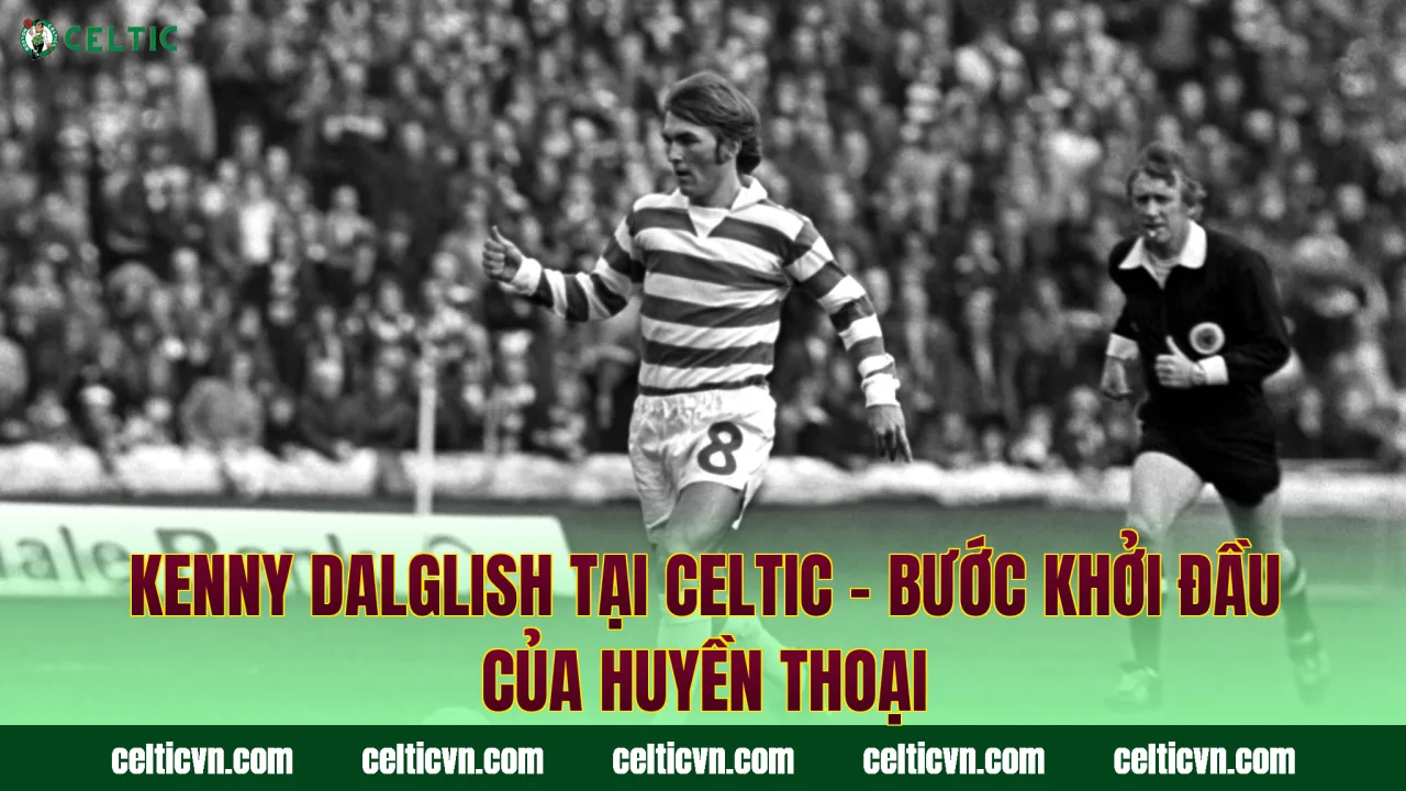 Kenny Dalglish Tại Celtic – Bước Khởi Đầu Của Huyền Thoại